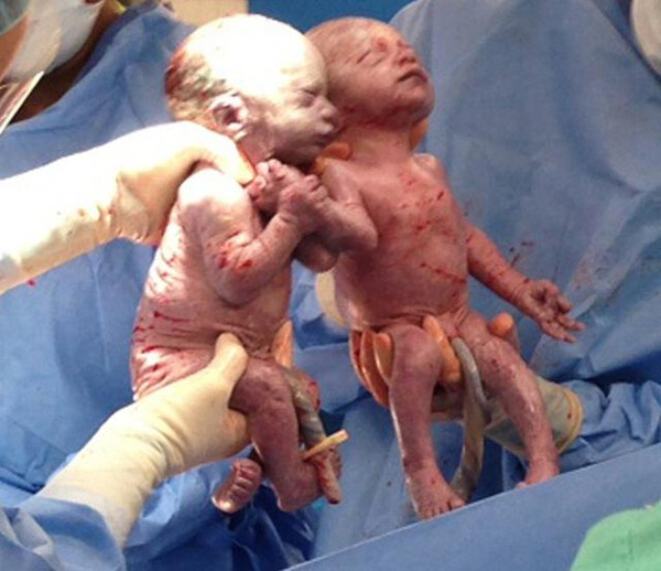 刚出生双胞胎儿子图片图片