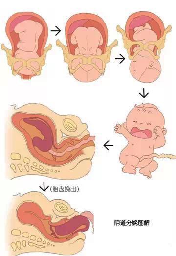胎儿顺产步骤图片图片