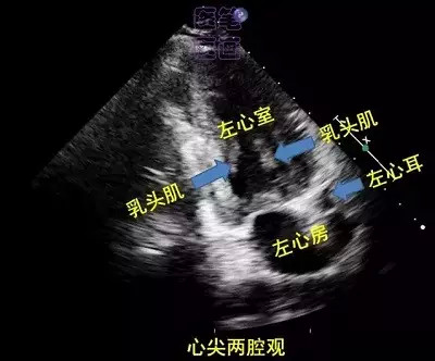 心尖四腔觀:兩個小雪人心尖四腔觀異切面:小情侶作者:陳海燕來源: