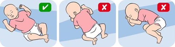 新近的一些研究提出,侧睡和趴着睡发生新生儿猝死的危险是差不多的