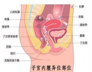 子宫和盆腔的位置图图片