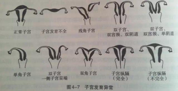 子宫呈梨形,是产生月经和孕育胎儿的器官,位于骨盆腔中央,在膀胱与