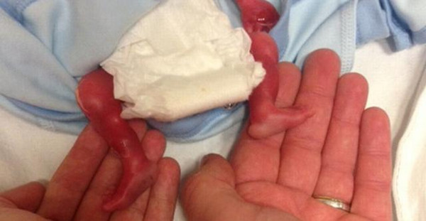 第一次也是最后一次握着你的小脚.