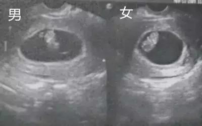 四个月胎儿性别对照图图片