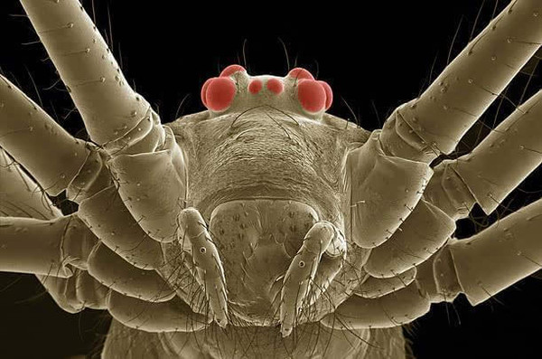 显微镜下的蜘蛛图片