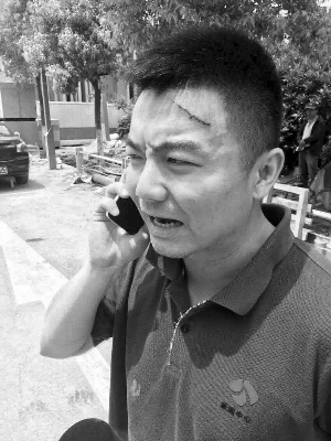 江苏电视台记者毛俊额头和前胸都有伤痕 当事人供图