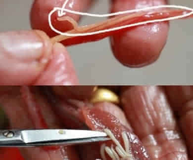 开水烫三次都不死的寄生虫!