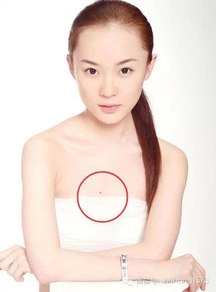 女人左乳房有红痣命运图片