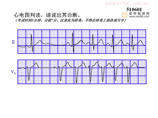 2015執業醫師實踐技能心電圖考試經驗總結圖解