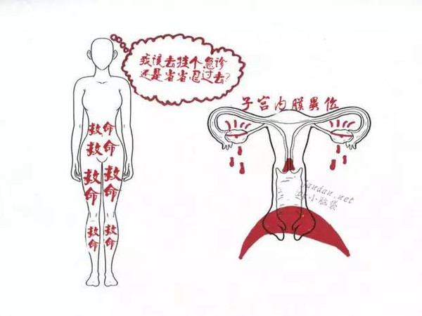 月经流血部位图解图片