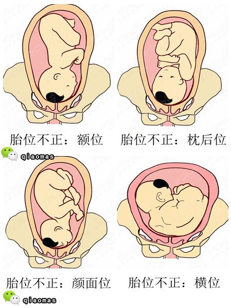 你肚子里的宝宝胎位正吗?快拿出b超单看看吧