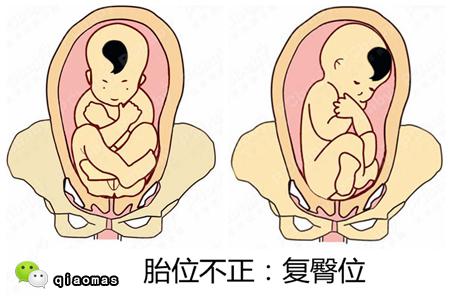 你肚子里的宝宝胎位正快拿出b超单一起看过来吧