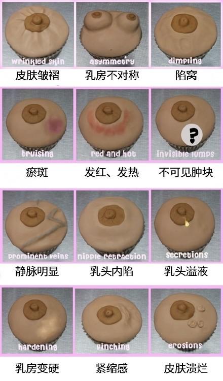 头号杀手乳腺癌12个情况要注意