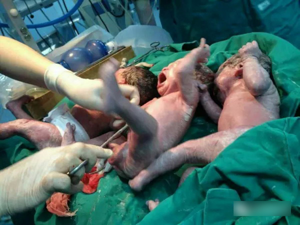 37周胎儿出生图片图片