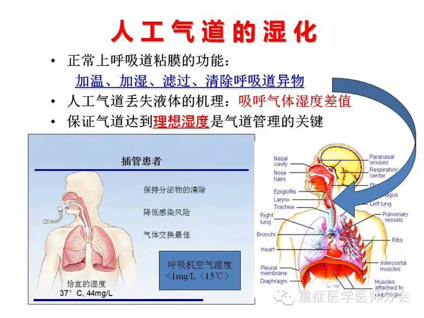 人工气道的湿化满意,使用人工鼻联合持续气道湿化技术湿化液量探讨