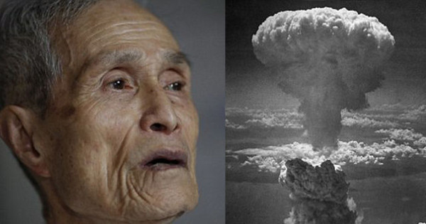 日本核爆幸存者秀出70年来严重变形的身体