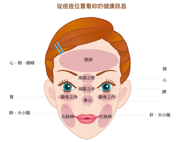 之類的東西,早晚的潔面如果不徹底,或者晚上帶妝睡覺,臉頰兩側長痘痘