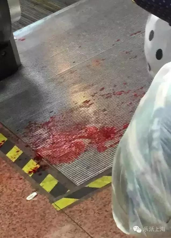 上海手扶电梯咬人?伤者手臂血流不止