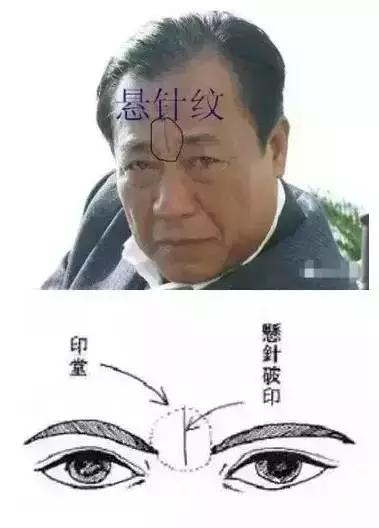 印堂十字纹图片