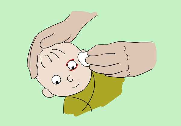 新生儿眼部护理图片