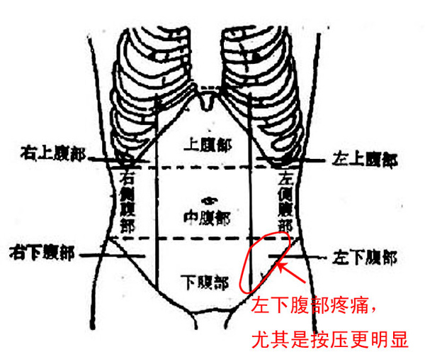 人体左下腹部隐隐作痛图片