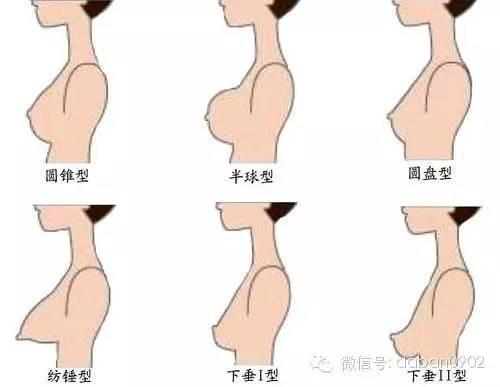 乳房分几型 说说文胸与胸型的那些事儿