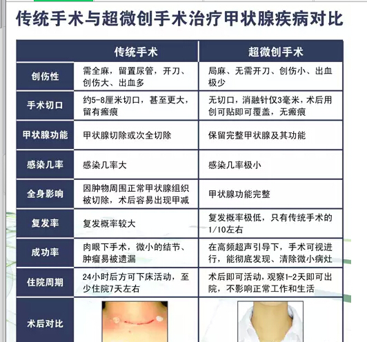 甲狀腺微創手術能清理乾淨嗎?——超微創精準可視