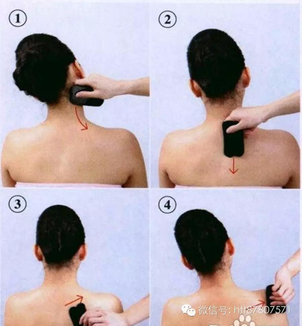 颈肩部刮痧出痧示意图图片