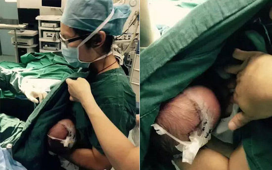 宝宝手术哭闹不止,美丽护士哺乳安抚