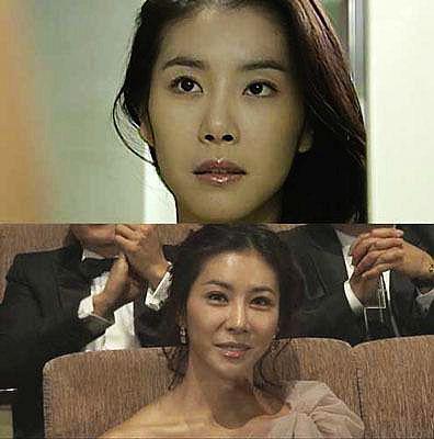 韩国女星整容失败图片