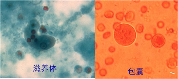 引起阿米巴痢疾的病原体是一种叫做溶组织内阿米巴的原虫,主要通过