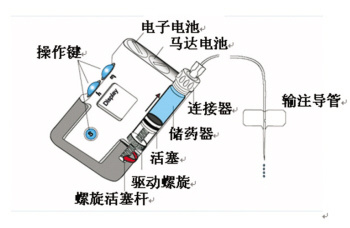 胰岛素泵 工作原理图片