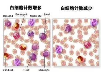 抗甲状腺药物治疗甲亢最易发生粒细胞减少的时间是初始治疗的 a.