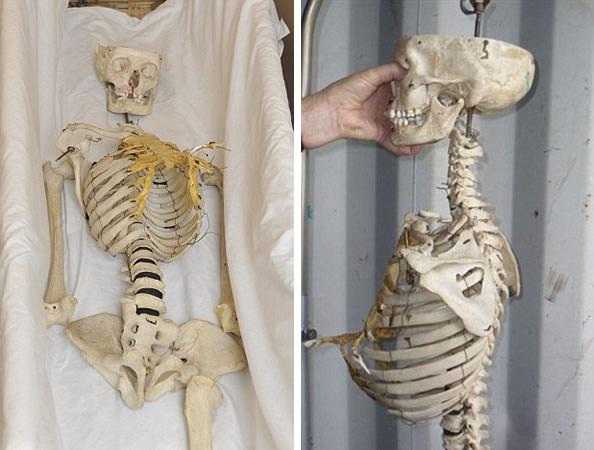 教学使用的人骨模型居然是真人骨