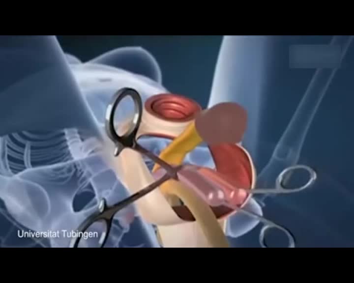 变性手术模具动画图片