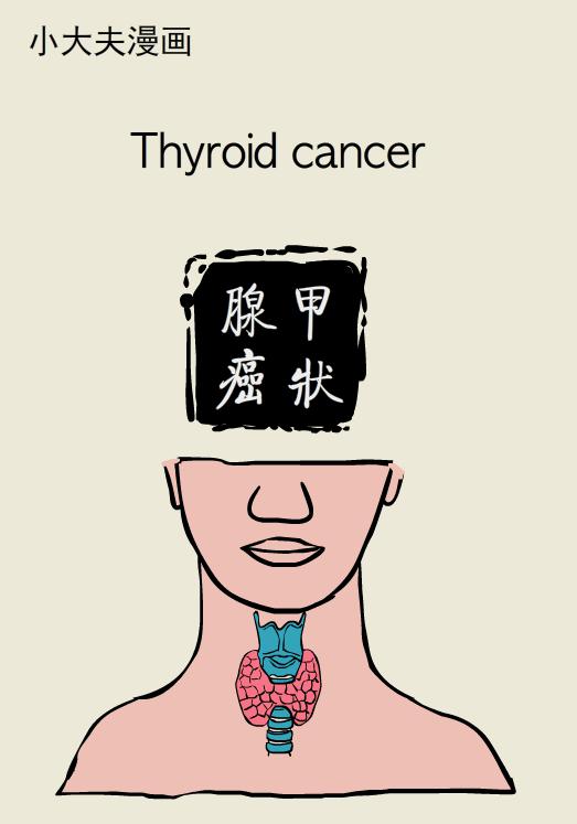 疾病名稱:甲狀腺癌 所屬部位:頸部 甲狀腺癌(thyroid carcinoma