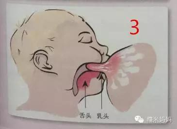 婴儿吃奶舌头图片