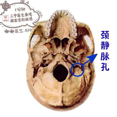 据高喆副主任医师介绍,很幸运,筷子从东东的颈静脉孔穿过,没有伤到大