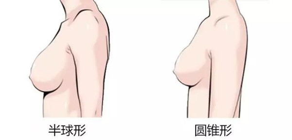 乳腺手术后穿什么内衣_乳腺纤维瘤手术后照片