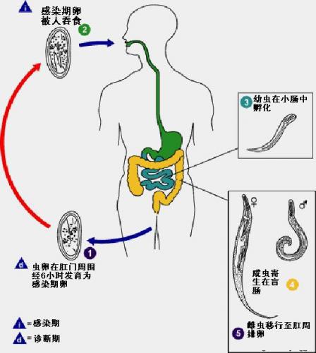 5岁女童的肛门竟排出60余条小虫,原来是它