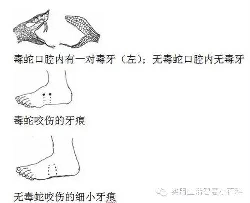 被毒蛇咬了怎么急救