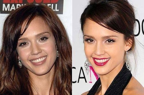 整鼻子已成为欧美明星的标配