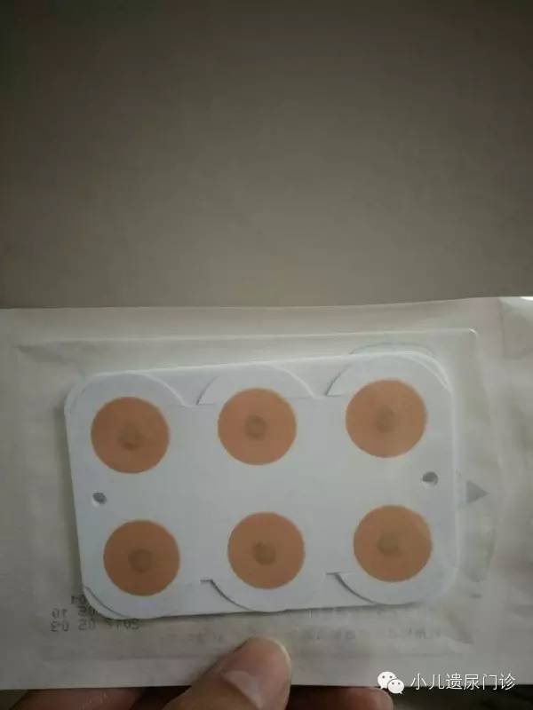 孩子便秘揿针一穴解决