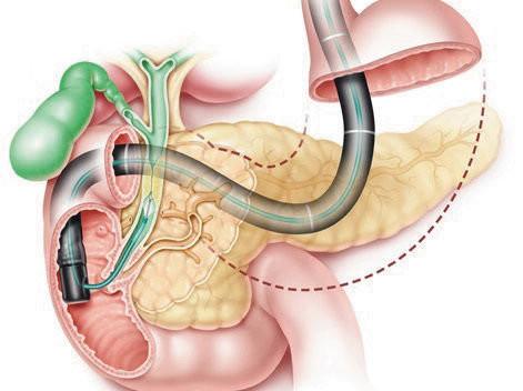 痛风的辅助检查有哪些原因