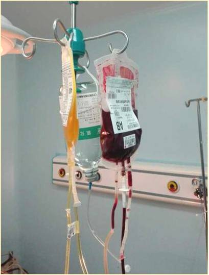 输血照片真实图片清晰图片