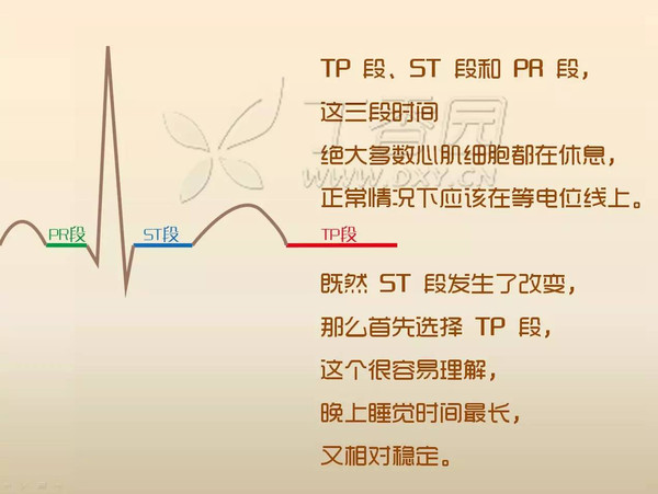 心电图st段的生理意义图片