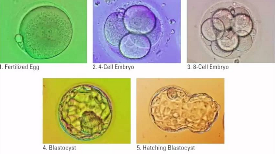 未成熟卵母细胞体外成熟技术