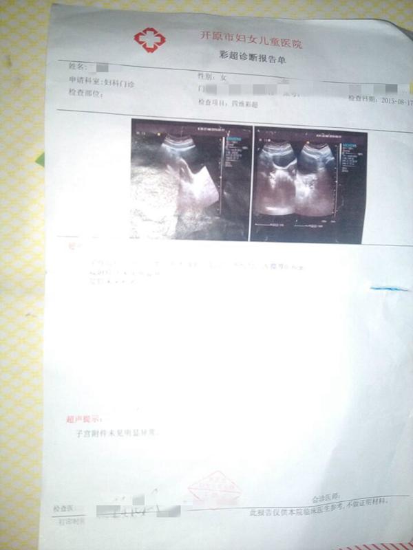早孕超声报告单模板图片