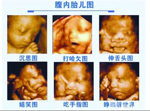 怀孕六十天胎儿图片图片