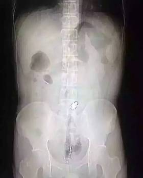 2๫˾ᣬͬ°ҹˣȥġ˵